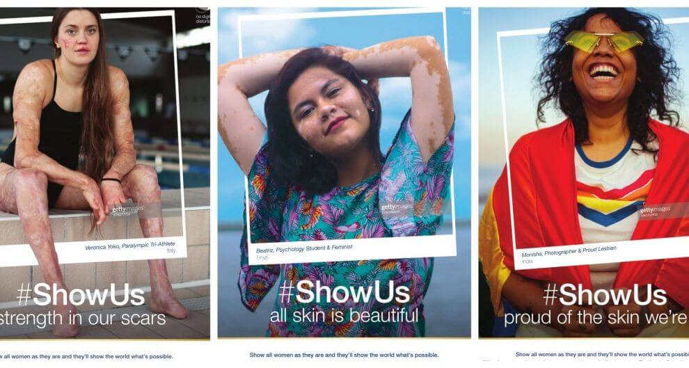Dove partnered with women & non-binary individuals everywhere to create Project #ShowUs, a collection of 10,000+ images that offer a more inclusive vision of beauty for all media & advertisers to use. 